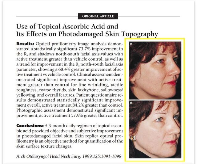 Use of Topical Ascorbic Acid and Its Effects on Photodamaged Skin Topography (Traikovich, 1999) — ข้อความบางส่วนจากเอกสาร